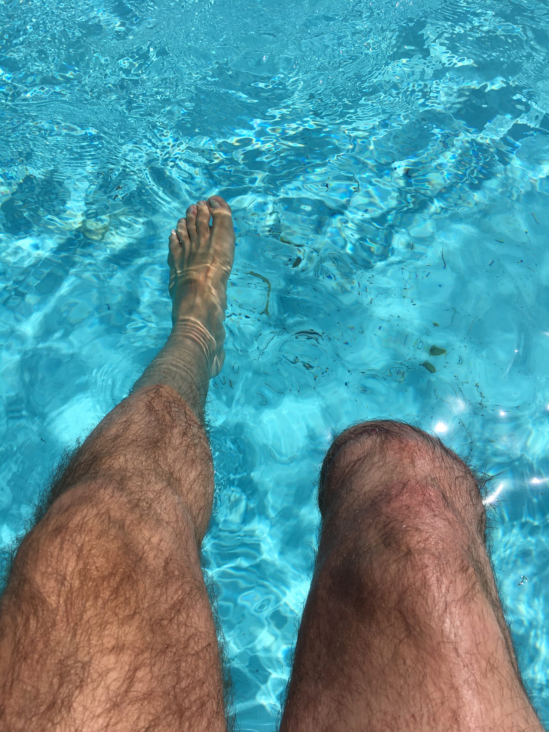 Esta imagen molesta. Un trasplantado.