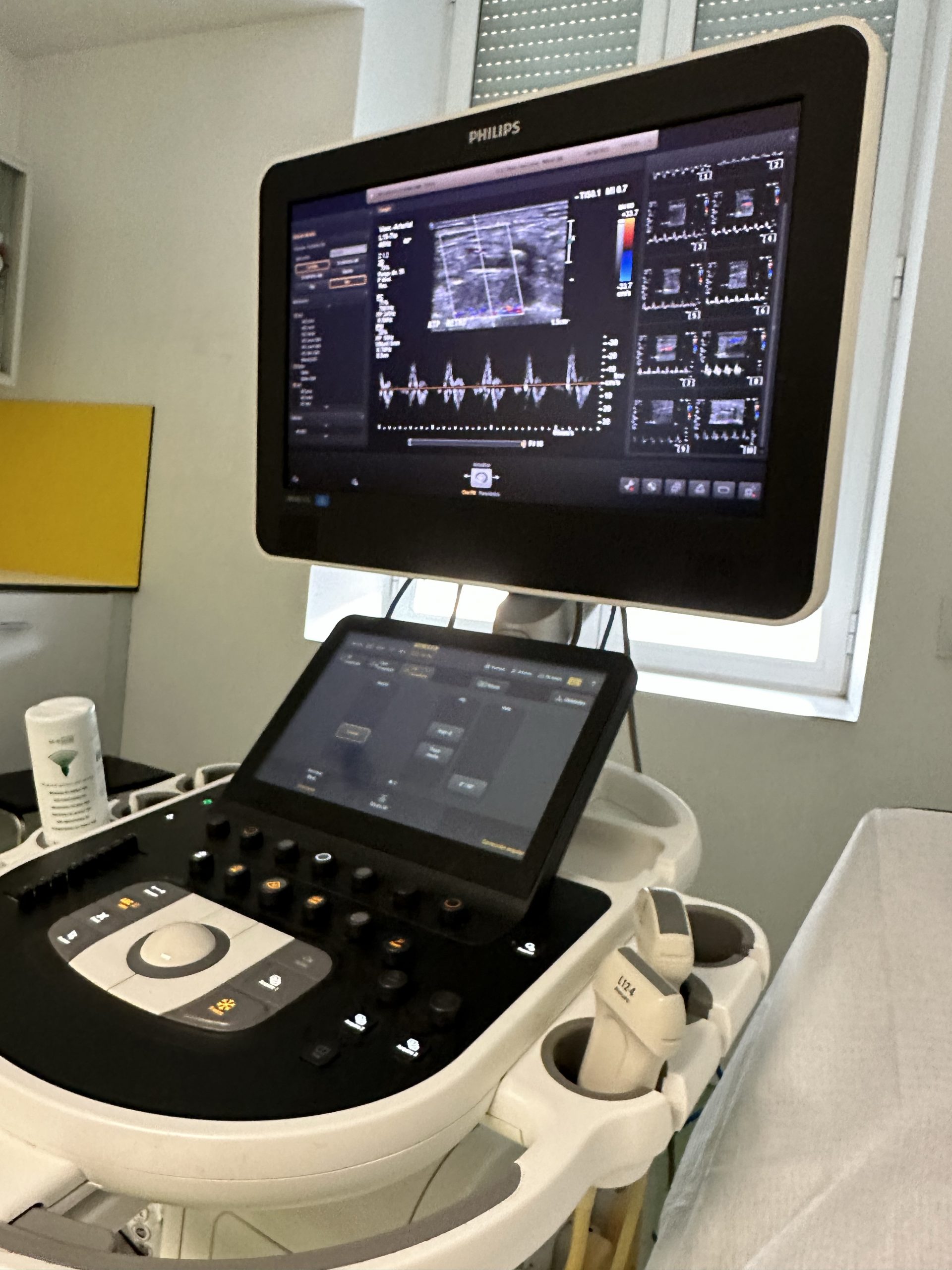 La pierna aguanta. Un trasplantado