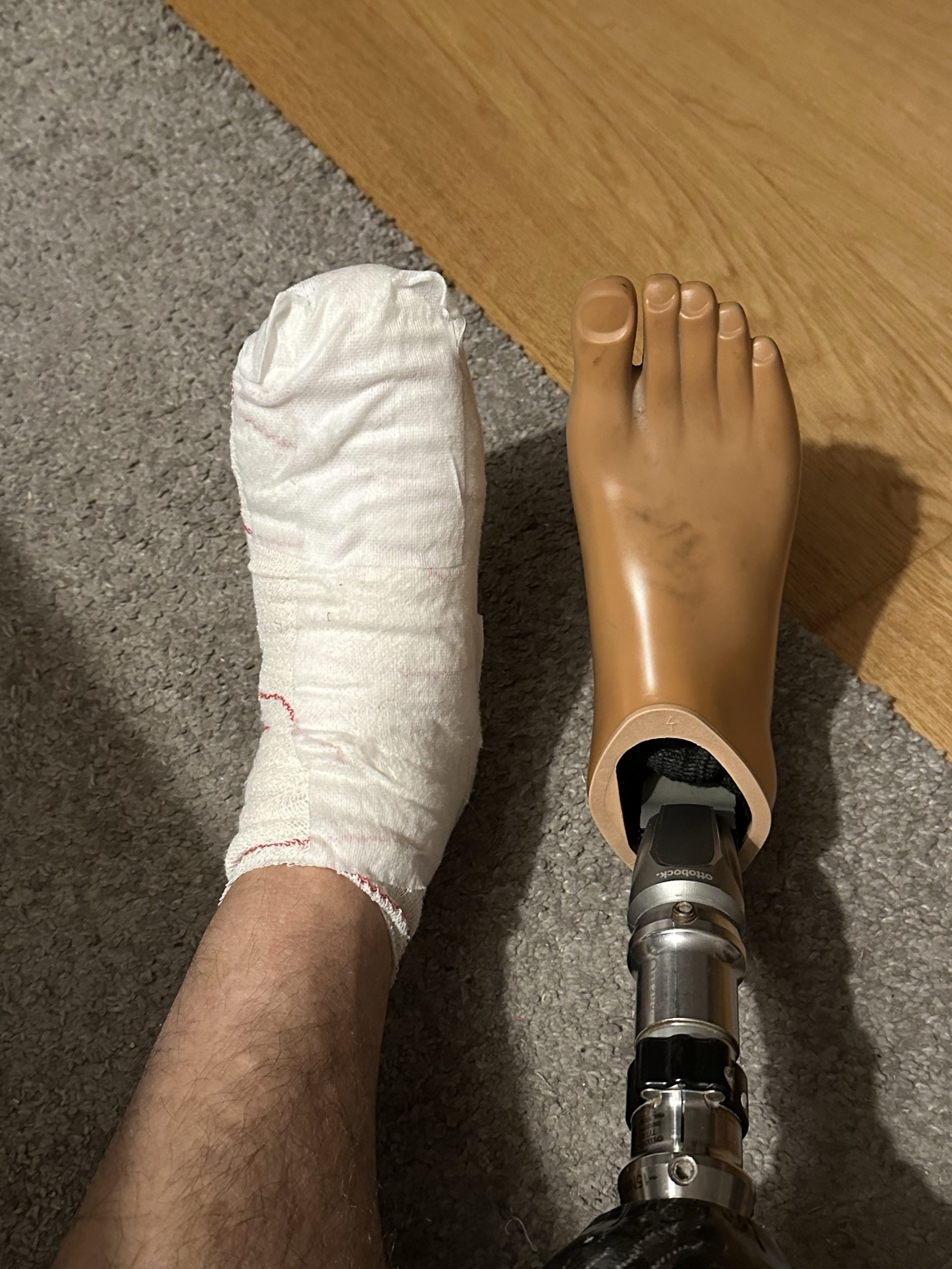 Cada recaída, es un paso adelante. Un trasplantado.