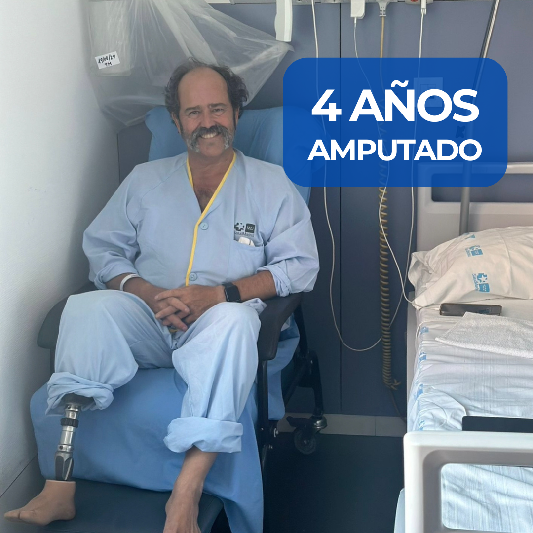 4 años amputado. Un trasplantado.