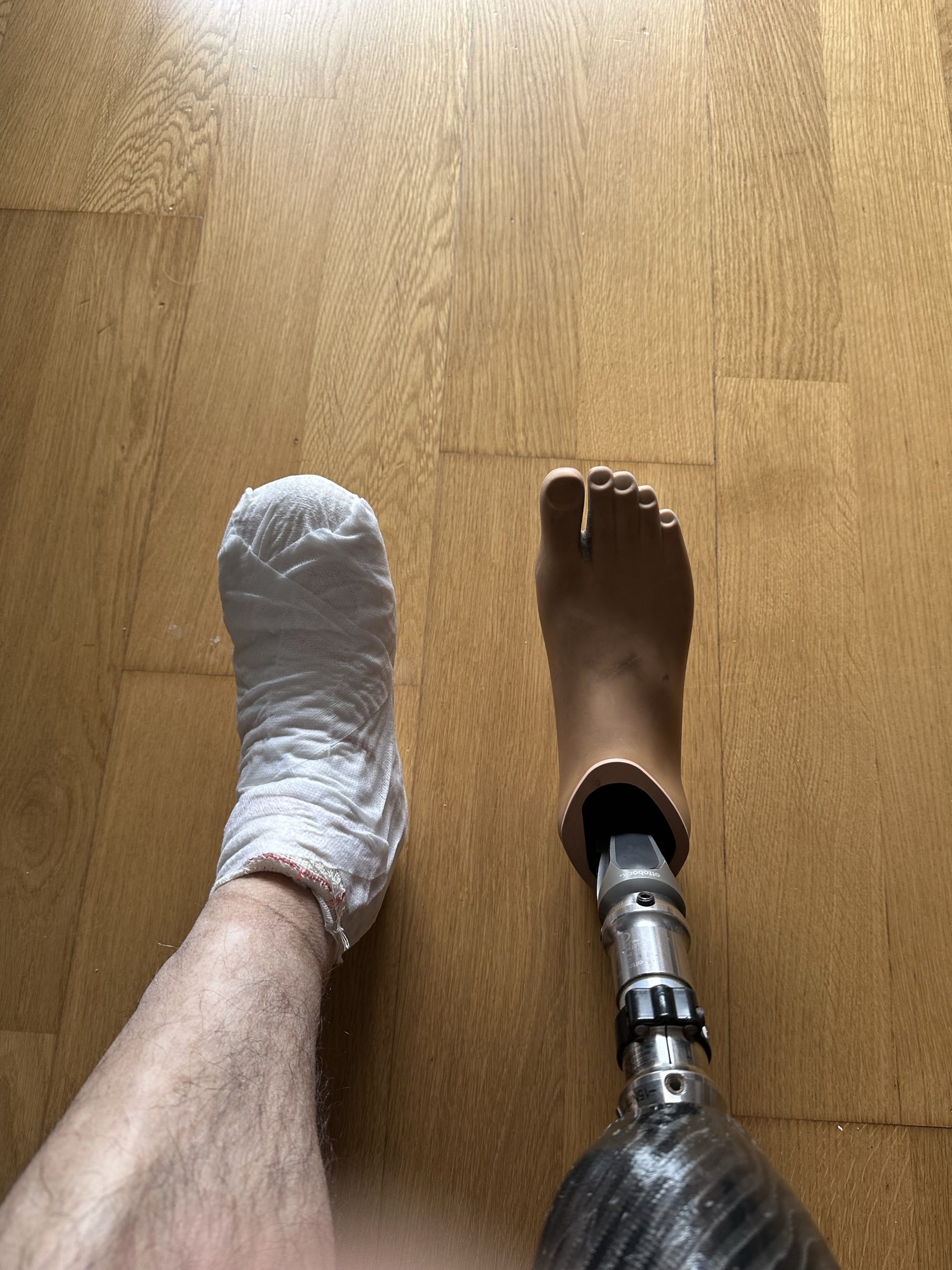 Susto o muerte. Un trasplantado.