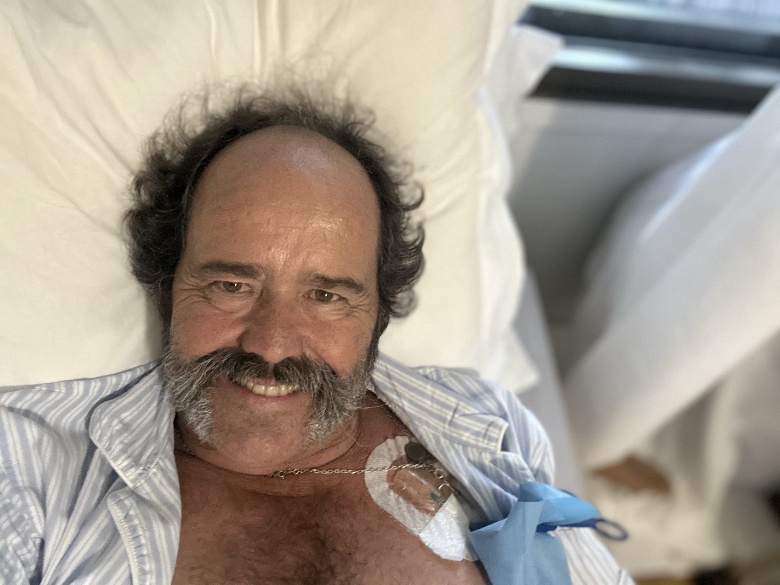 El ofrecimiento de obras. Un trasplantado.